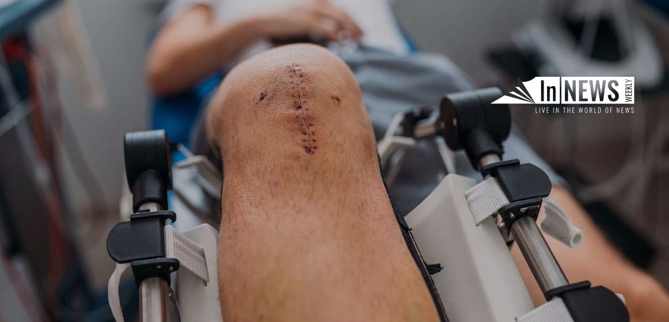 Scarring And Disfigurement Cases