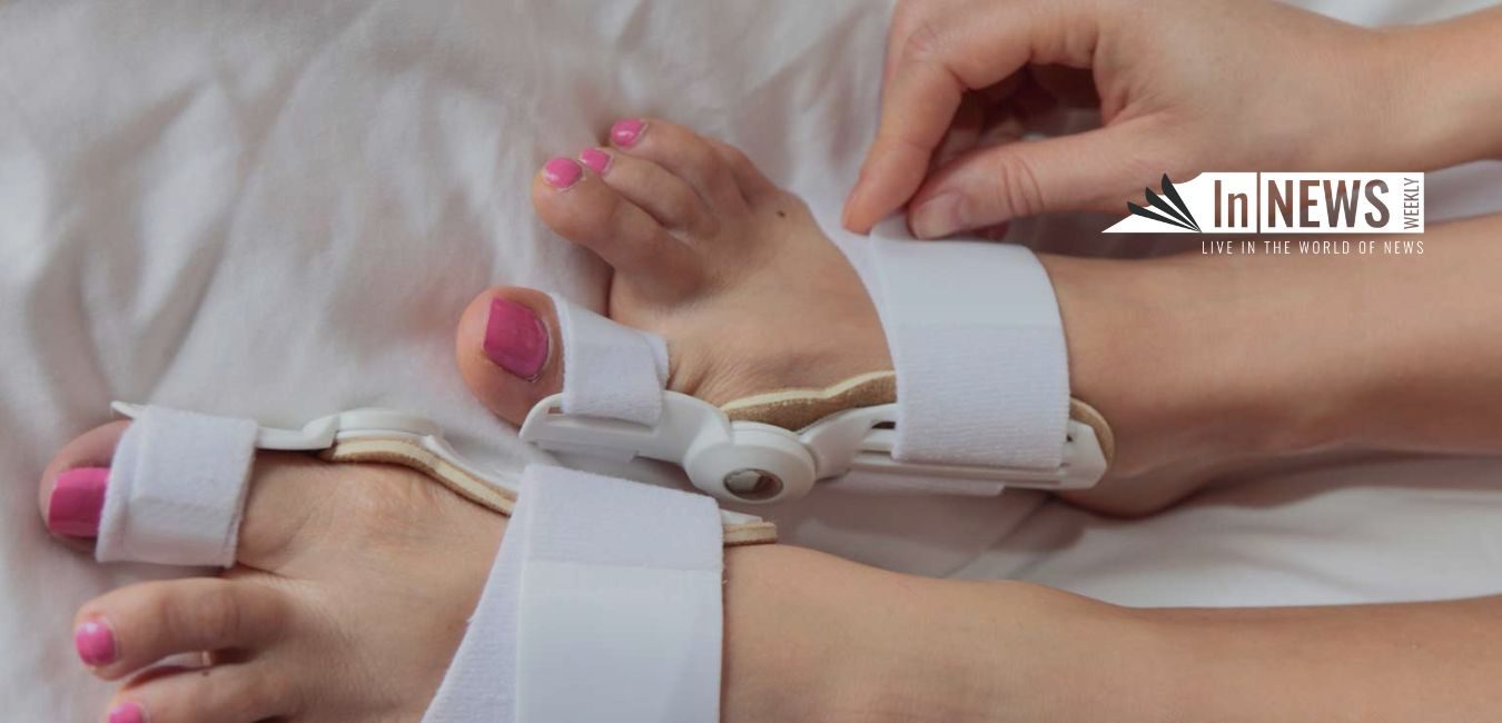 Treatments For Bunions